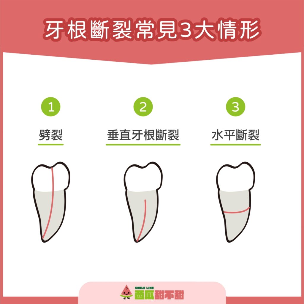 西瓜甜不甜-牙根斷裂