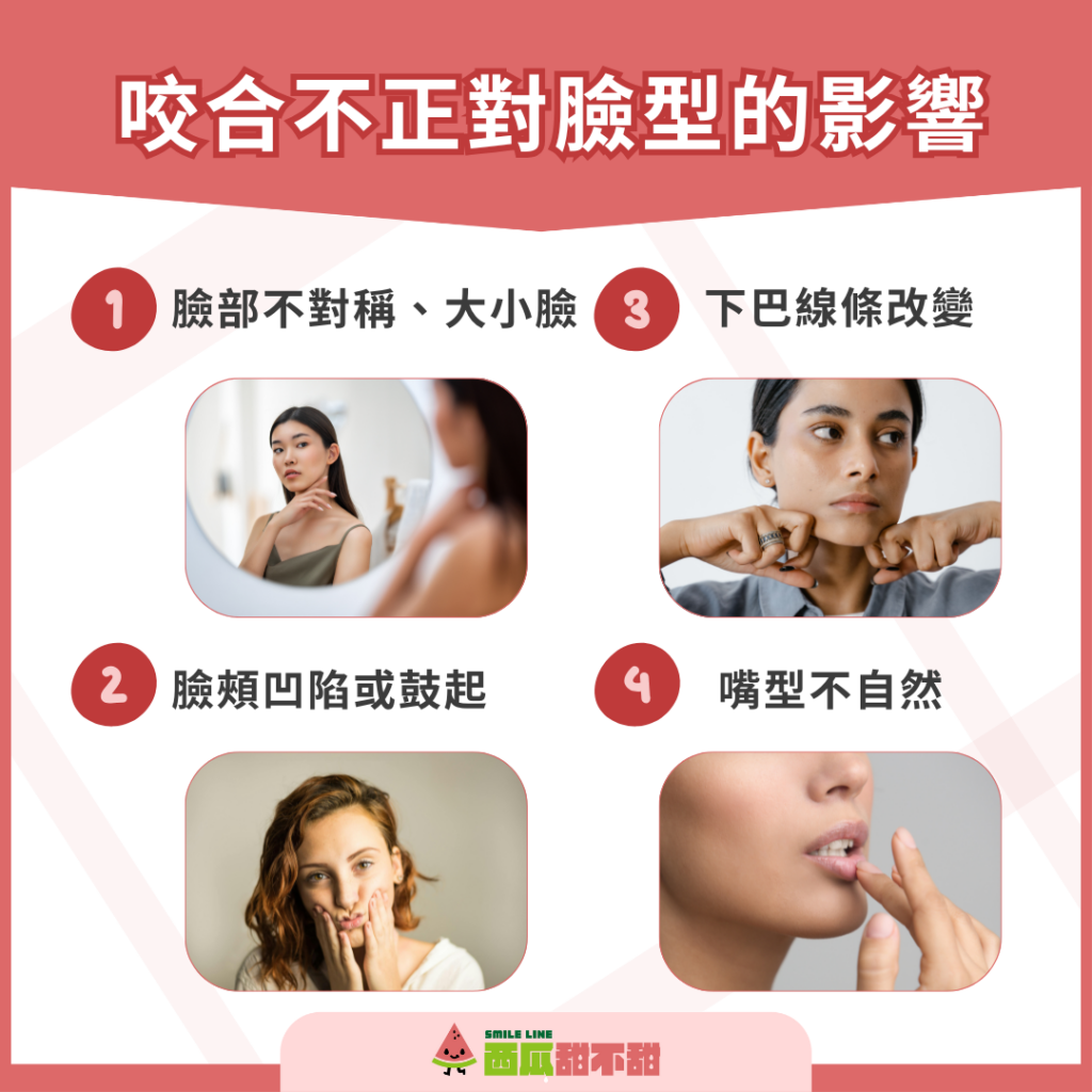 咬合不正對臉型的影響