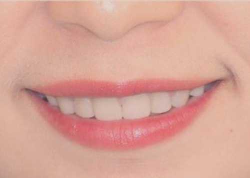 實際完成的陶瓷貼片成果