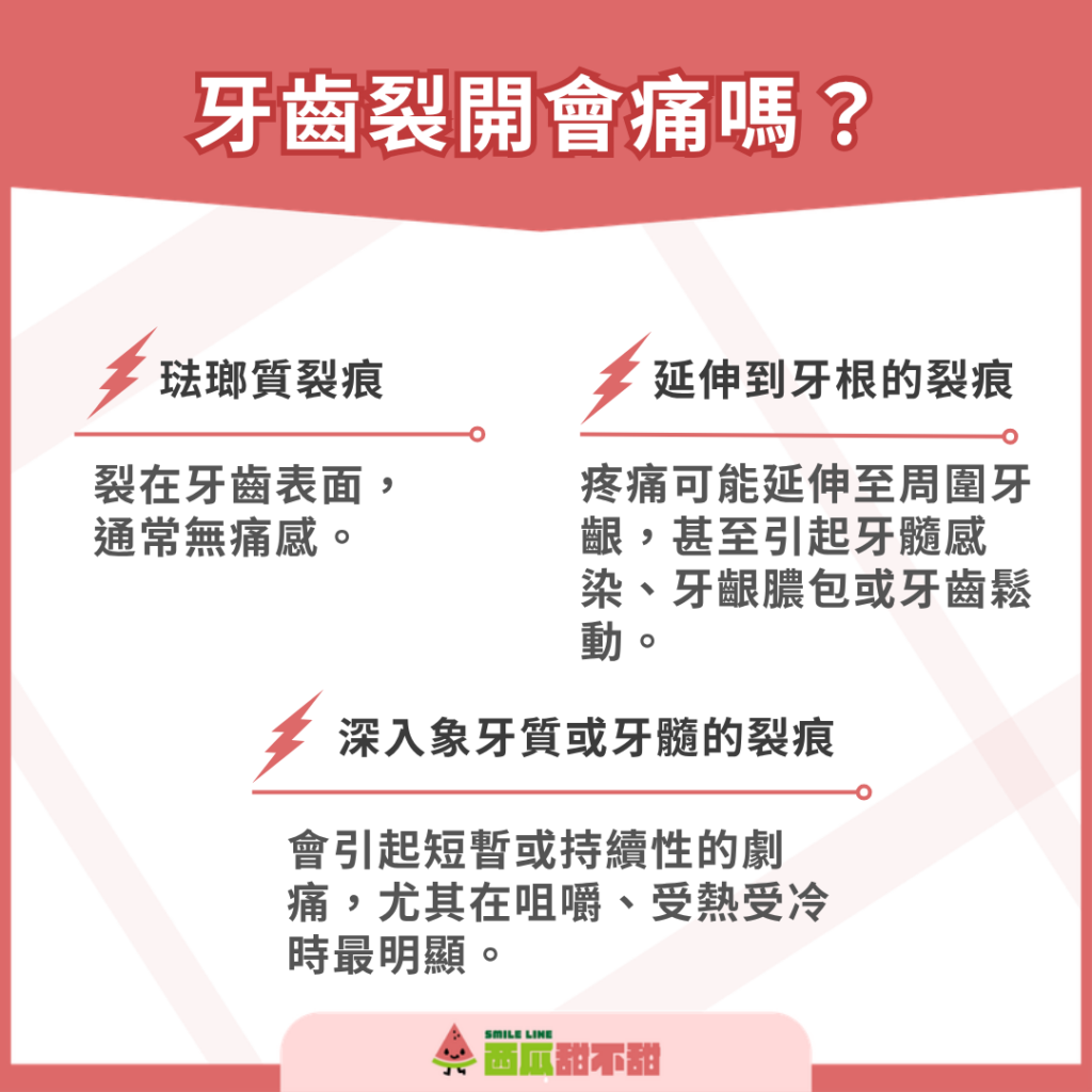 牙齒裂開會痛嗎?哪些情況需警覺?